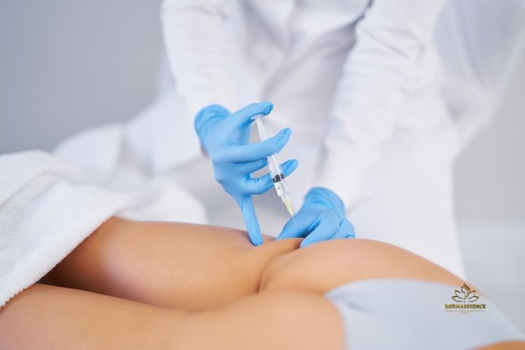 Endopeel Gluteos