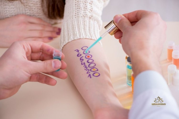 Pruebas de Alergia