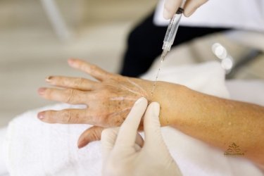 Bioestimulación