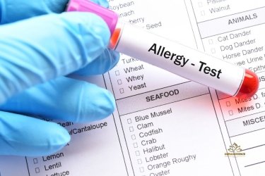 Alergia a Alimentos